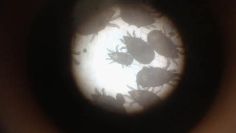 Eine Mikroskopaufnahme von Milben.